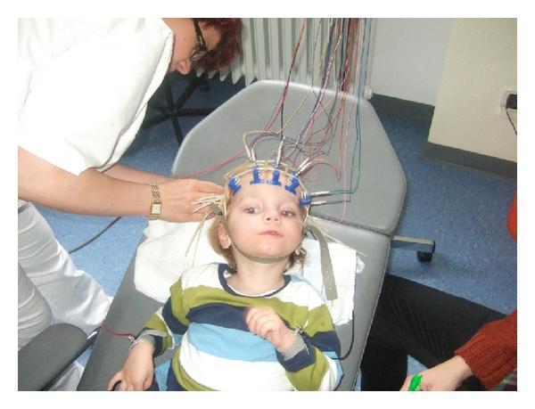 boy, 2.5 years old, suffering servere brain damage after cardiac arrest